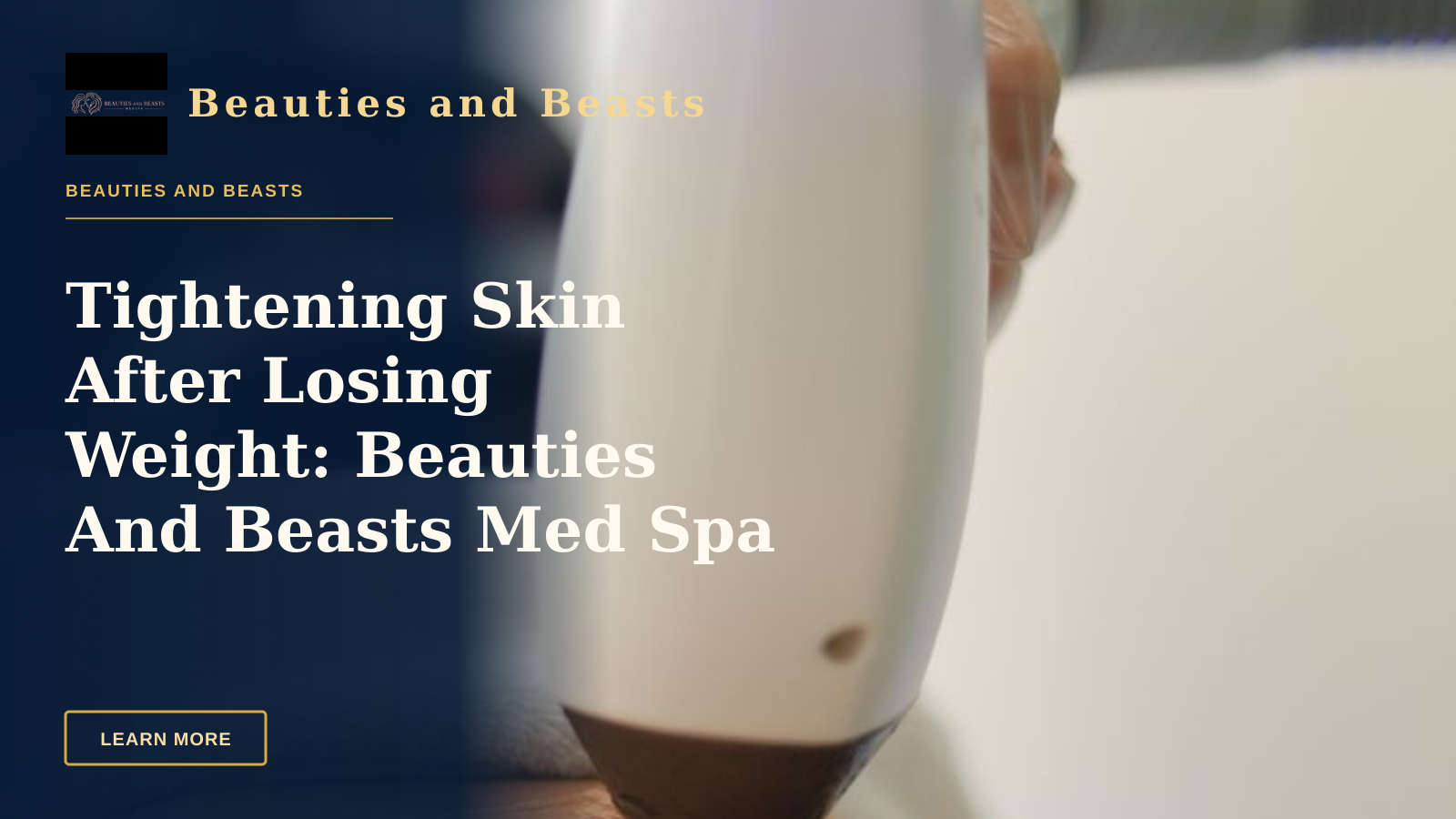 Tightening Skin After Losing Weight: Beauties And Beasts Med Spa — Detailed view of a laser treatment on skin at a medical clinic in İstanbul.
