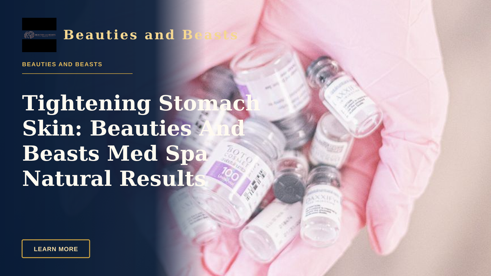 Tightening Stomach Skin: Beauties And Beasts Med Spa Natural Results