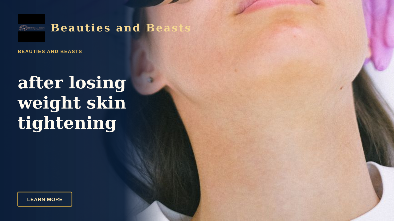after losing weight skin tightening