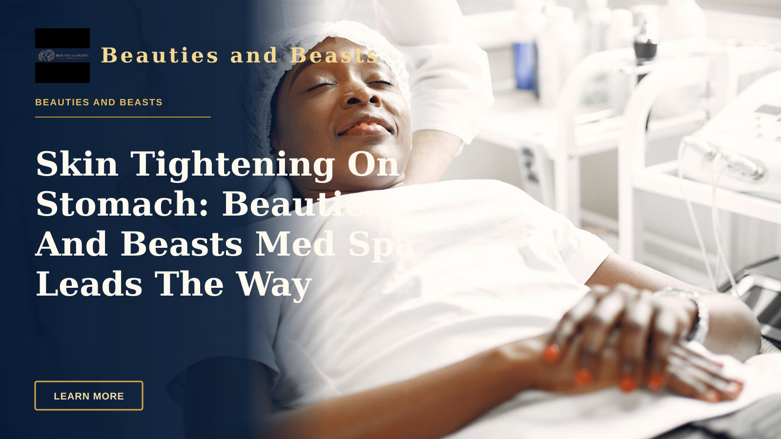 Skin Tightening On Stomach: Beauties And Beasts Med Spa Leads The Way