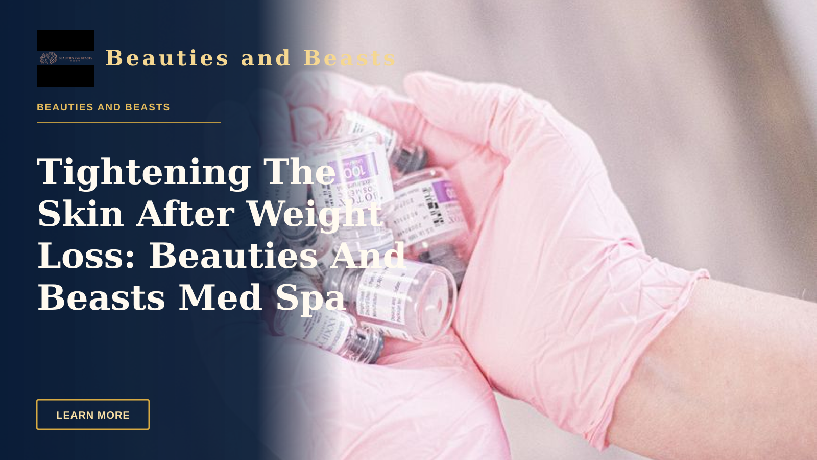 Tightening The Skin After Weight Loss: Beauties And Beasts Med Spa