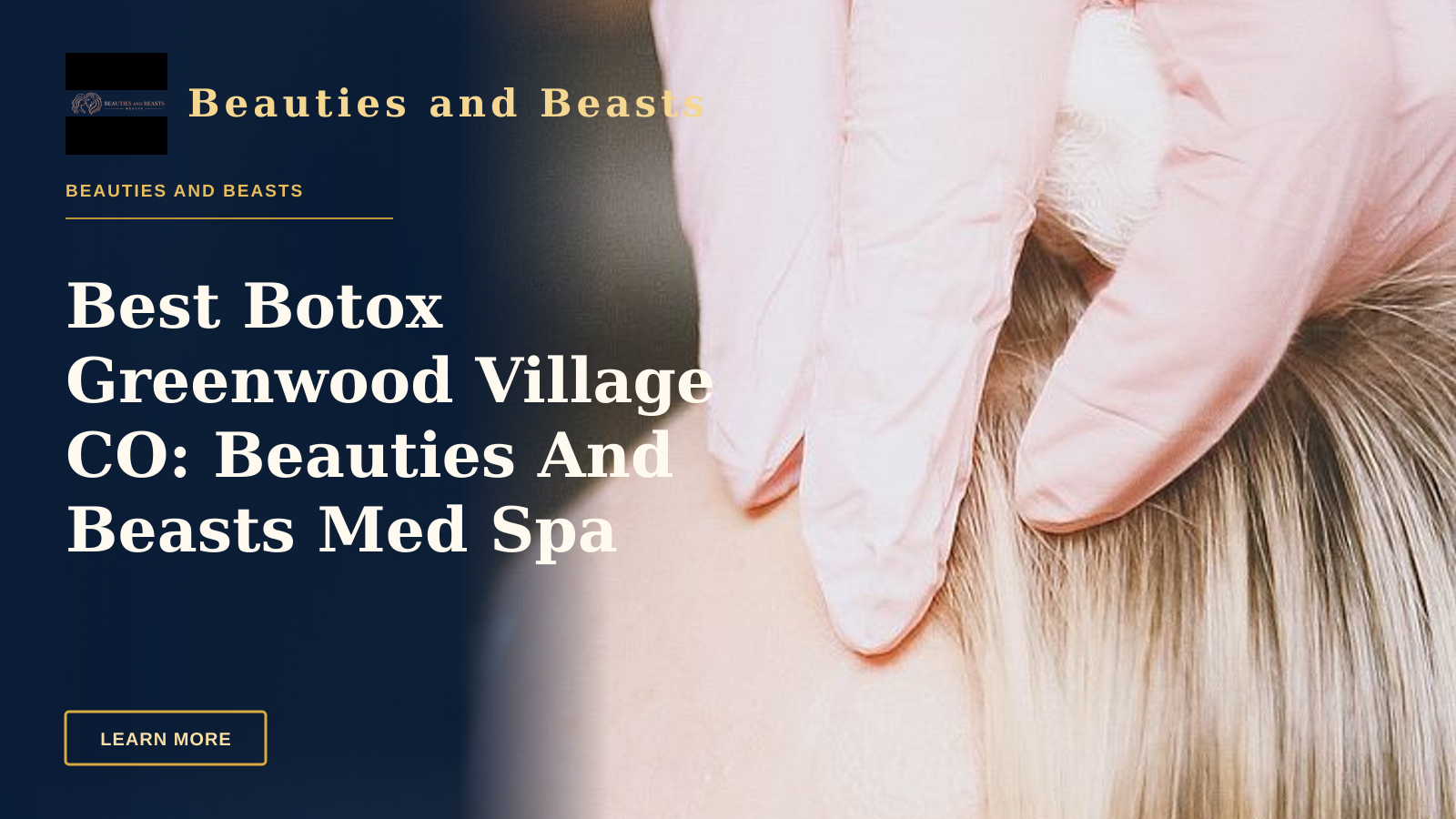 Best Botox Greenwood Village CO: Beauties And Beasts Med Spa Delivers