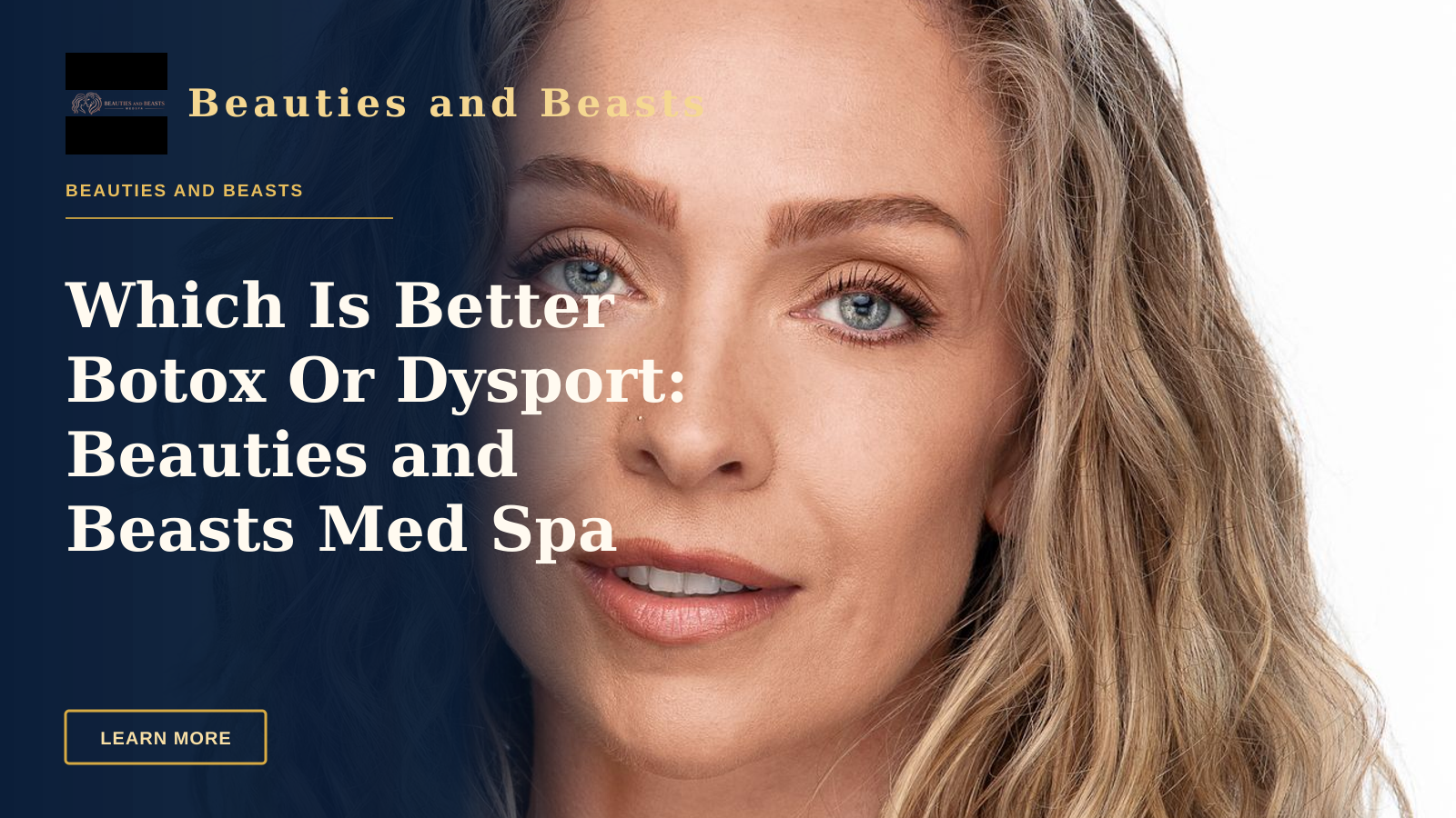 Which Is Better Botox Or Dysport: Beauties and Beasts Med Spa