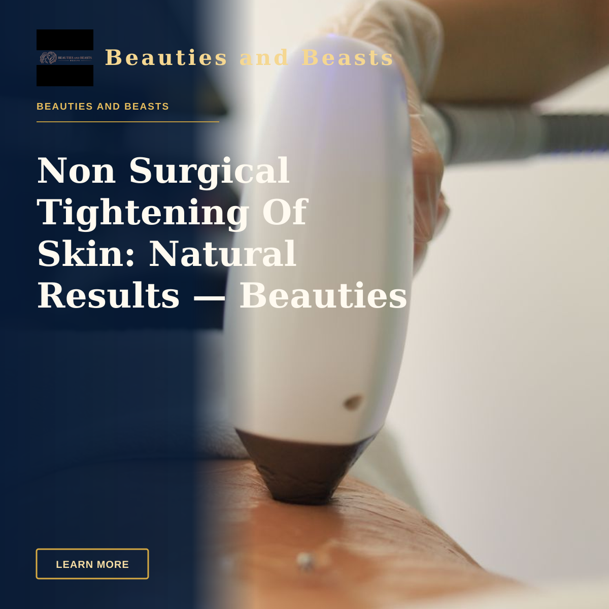 Non Surgical Tightening Of Skin: Natural Results — Beauties And Beasts Med Spa — Detailed view of a laser treatment on skin at a medical clinic in İstanbul.