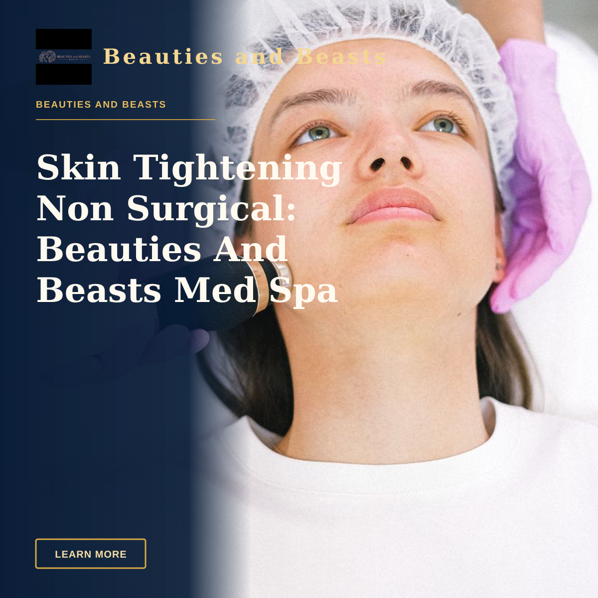 Skin Tightening Non Surgical: Beauties And Beasts Med Spa — Woman receiving laser skincare treatment at a clinic.