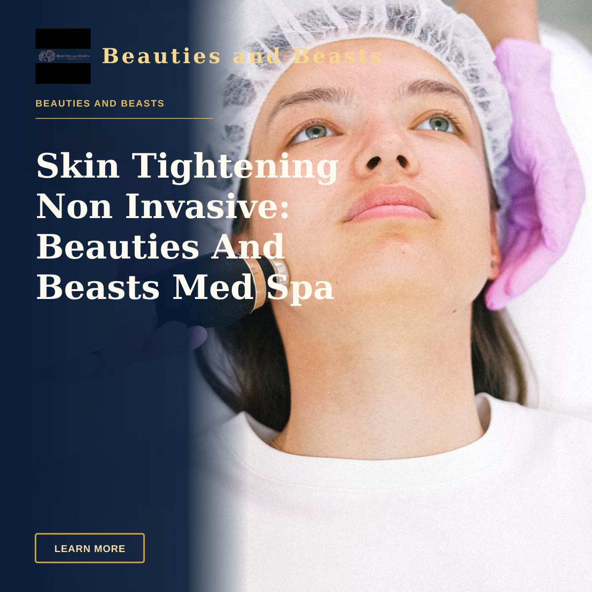 Skin Tightening Non Invasive: Beauties And Beasts Med Spa — Woman receiving laser skincare treatment at a clinic.
