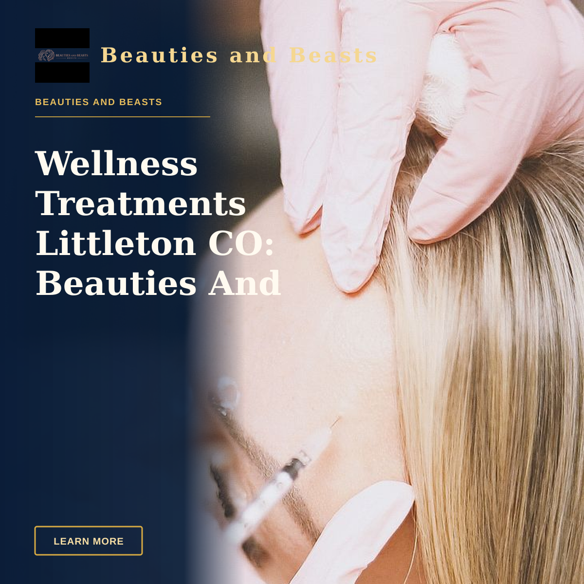 Wellness Treatments Littleton CO: Beauties And Beasts Med Spa Restores Balance — Close-up of a cosmetic injection procedure in a modern spa setting, enhancing beauty and wellness.