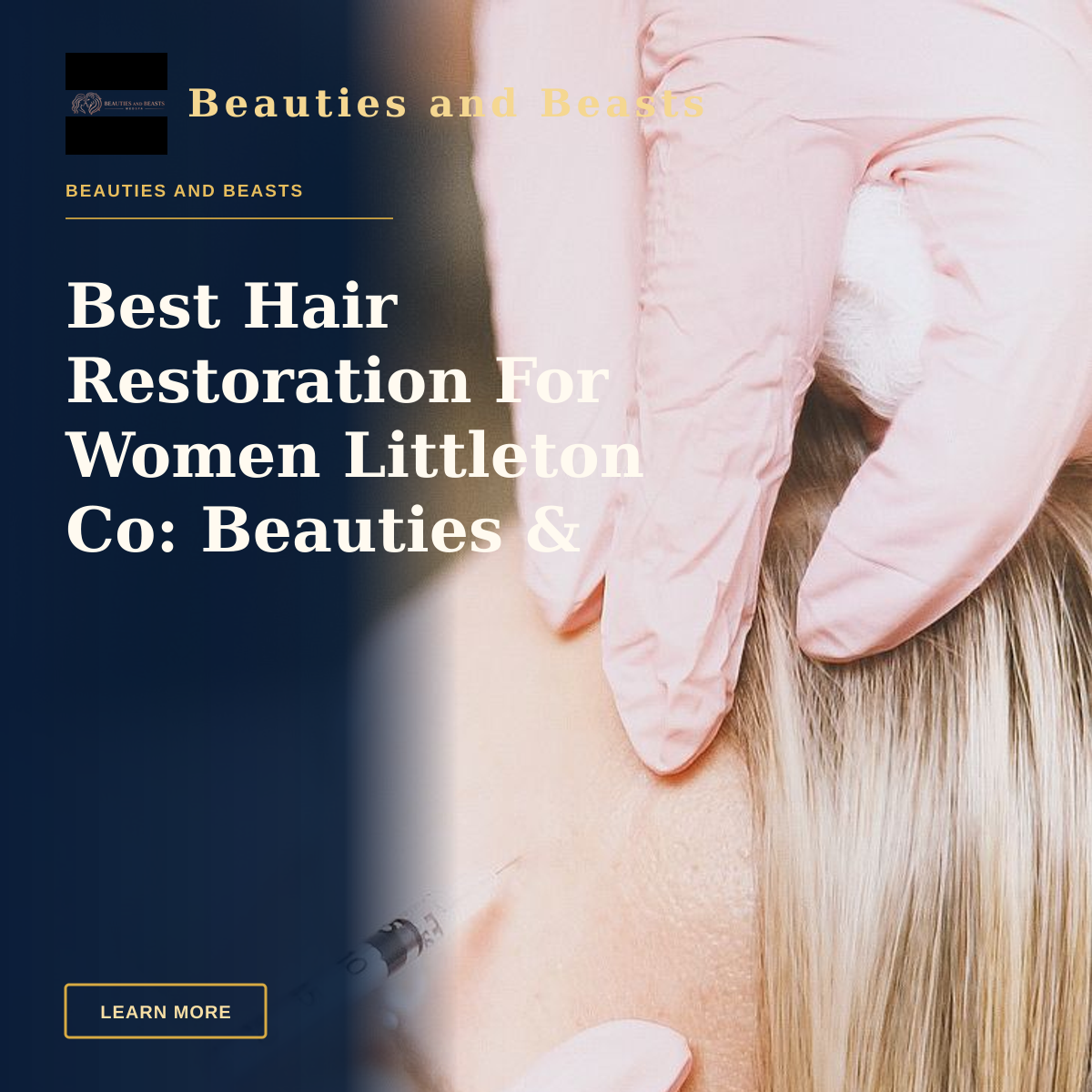 Best Hair Restoration For Women Littleton Co: Beauties & Beasts — Close-up of a cosmetic injection procedure enhancing facial features in a clinic setting.