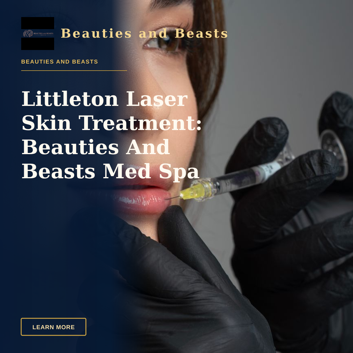 Littleton Laser Skin Treatment: Beauties And Beasts Med Spa Results — Detailed image of a cosmetic lip injection being administered by a professional.