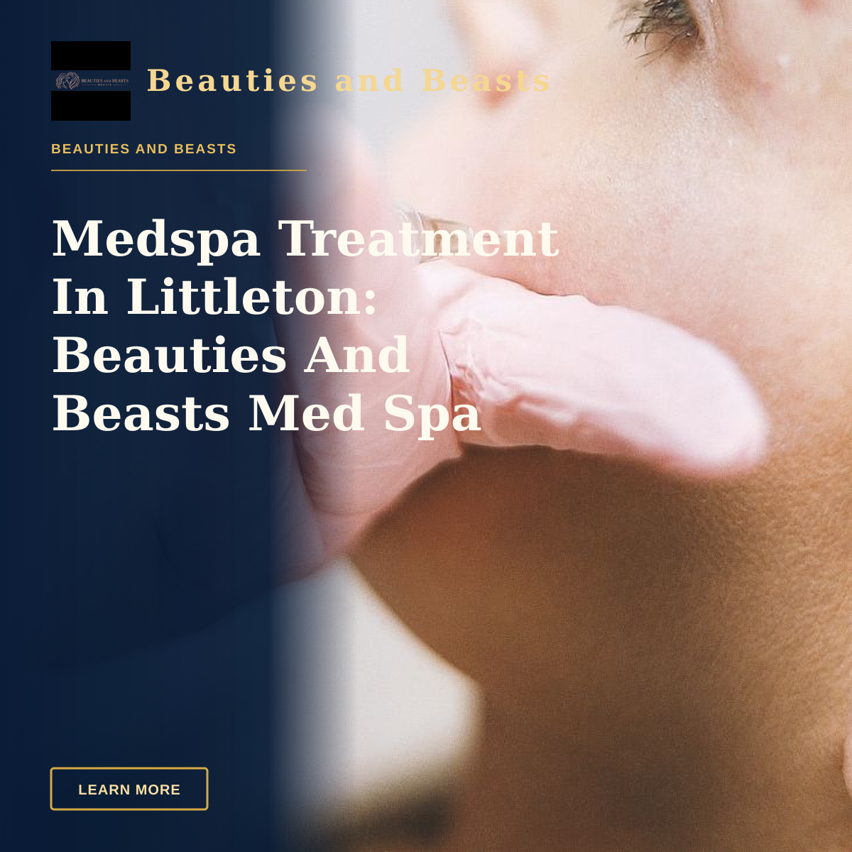 Medspa Treatment In Littleton: Beauties And Beasts Med Spa Delivers Results — A professional performing a cosmetic injection on a woman's cheek in a clinic.