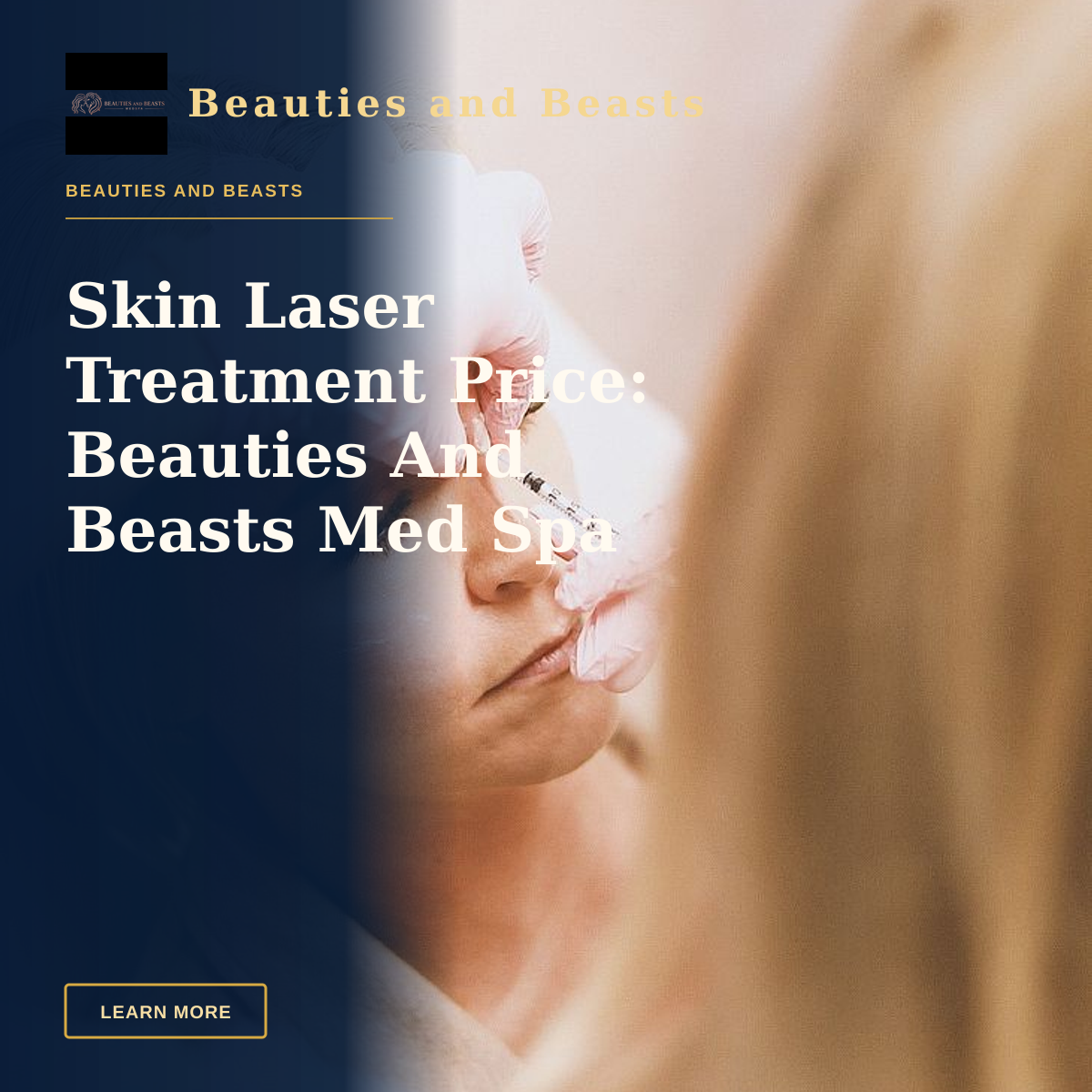 Skin Laser Treatment Price: Beauties And Beasts Med Spa Answers — Close-up of a woman receiving a cosmetic injection at a modern beauty clinic.