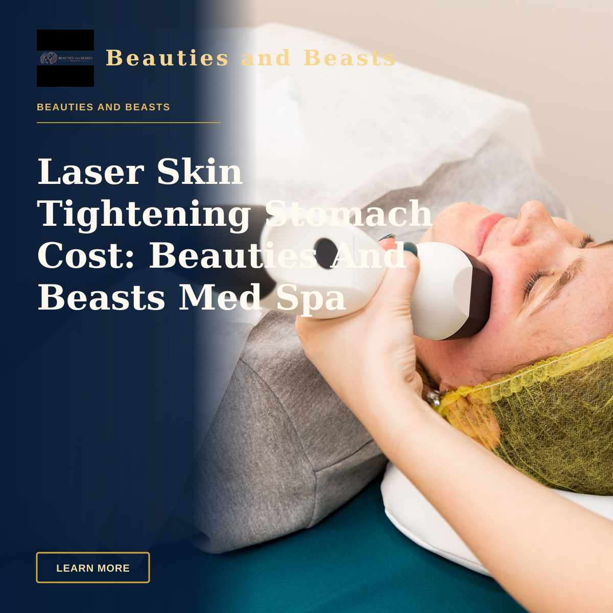 Laser Skin Tightening Stomach Cost: Beauties And Beasts Med Spa — A woman receiving professional facial treatment at a clinic, highlighting beauty and technology.