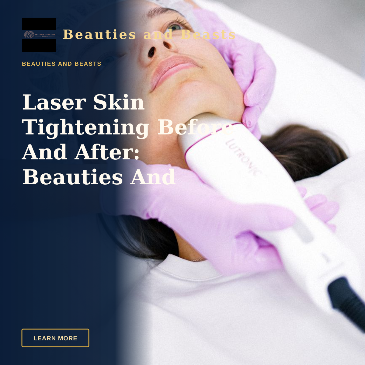 Laser Skin Tightening Before And After: Beauties And Beasts Med Spa — A cosmetologist performs a facial laser treatment on a young woman.