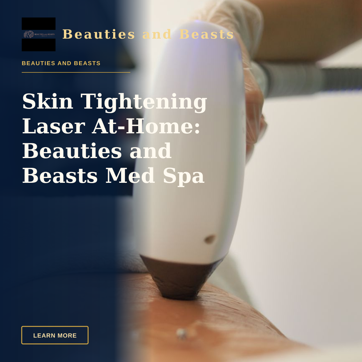 Skin Tightening Laser At-Home: Beauties and Beasts Med Spa — Detailed view of a laser treatment on skin at a medical clinic in İstanbul.