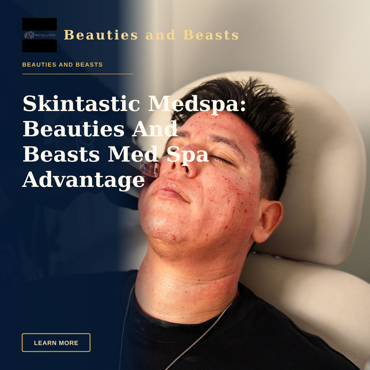 Skintastic Medspa: Beauties And Beasts Med Spa Advantage — Man receives Morpheus8 facial treatment in Santa Ana med spa for skincare rejuvenation.