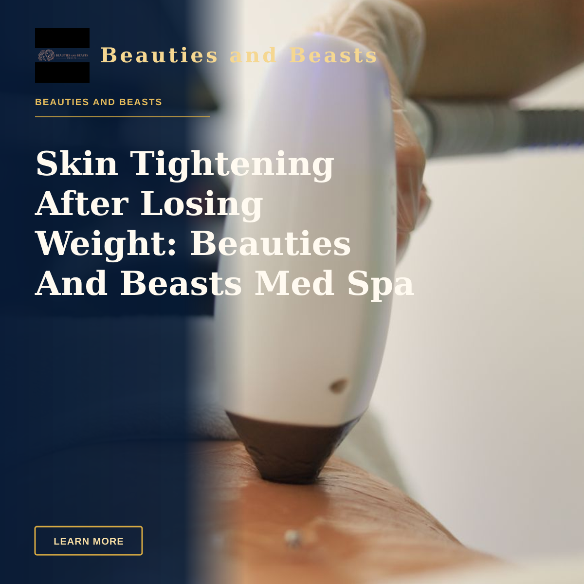 Skin Tightening After Losing Weight: Beauties And Beasts Med Spa — Detailed view of a laser treatment on skin at a medical clinic in İstanbul.