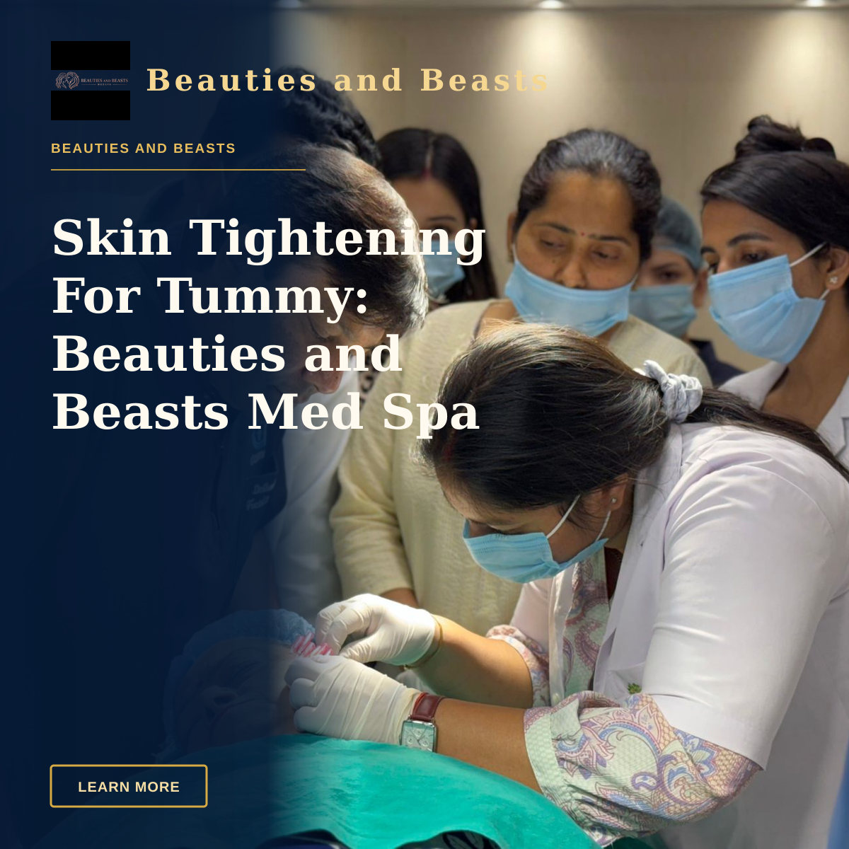 Skin Tightening For Tummy: Beauties and Beasts Med Spa — Healthcare professionals performing a cosmetic procedure in a New Delhi clinic.