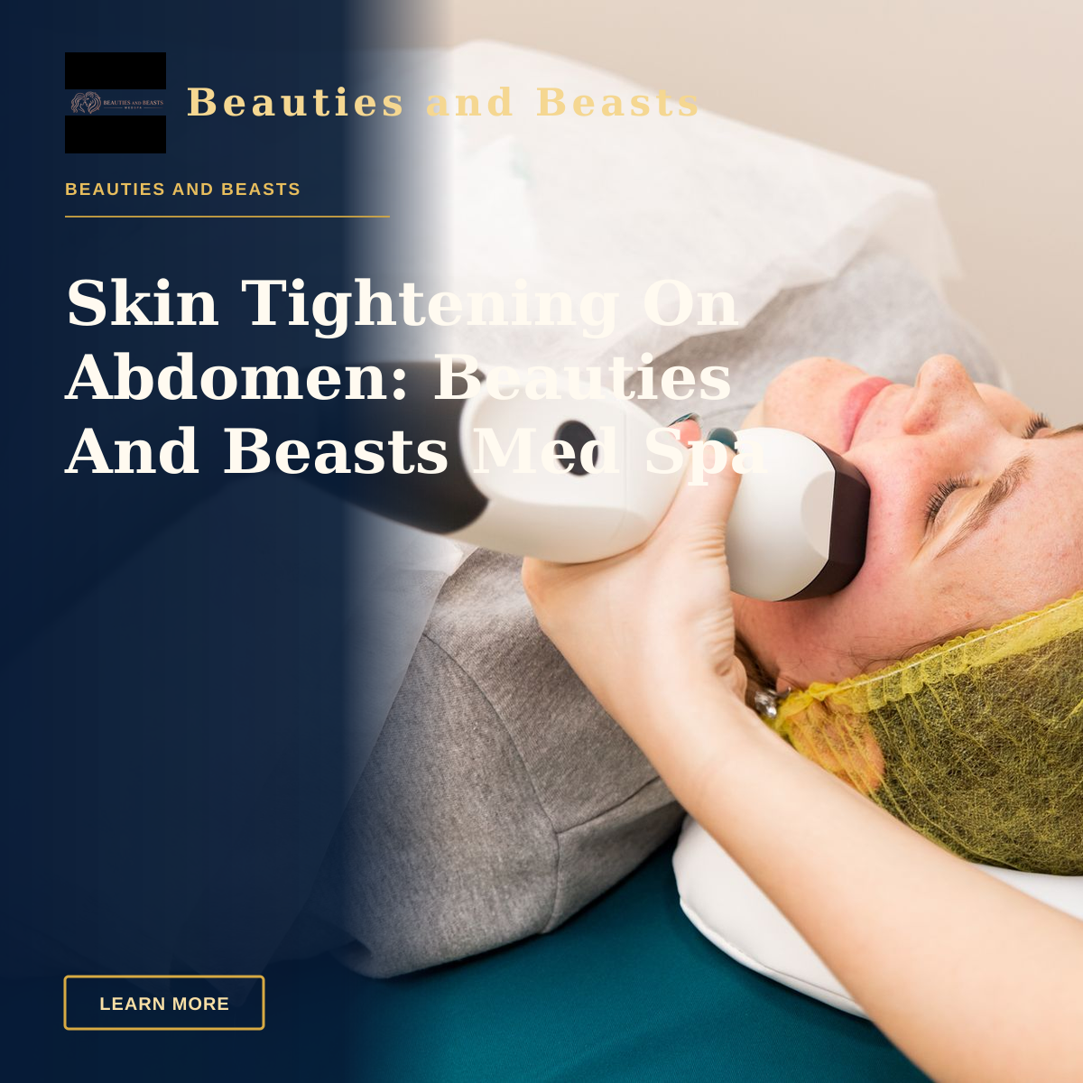 Skin Tightening On Abdomen: Beauties And Beasts Med Spa — A woman receiving professional facial treatment at a clinic, highlighting beauty and technology.