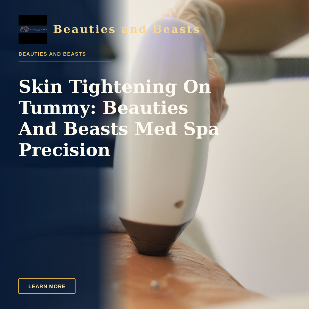 Skin Tightening On Tummy: Beauties And Beasts Med Spa Precision — Detailed view of a laser treatment on skin at a medical clinic in İstanbul.