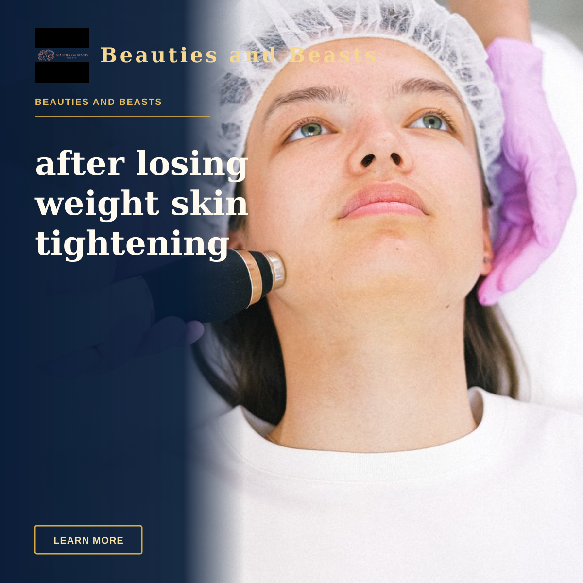 after losing weight skin tightening — Woman receiving laser skincare treatment at a clinic.