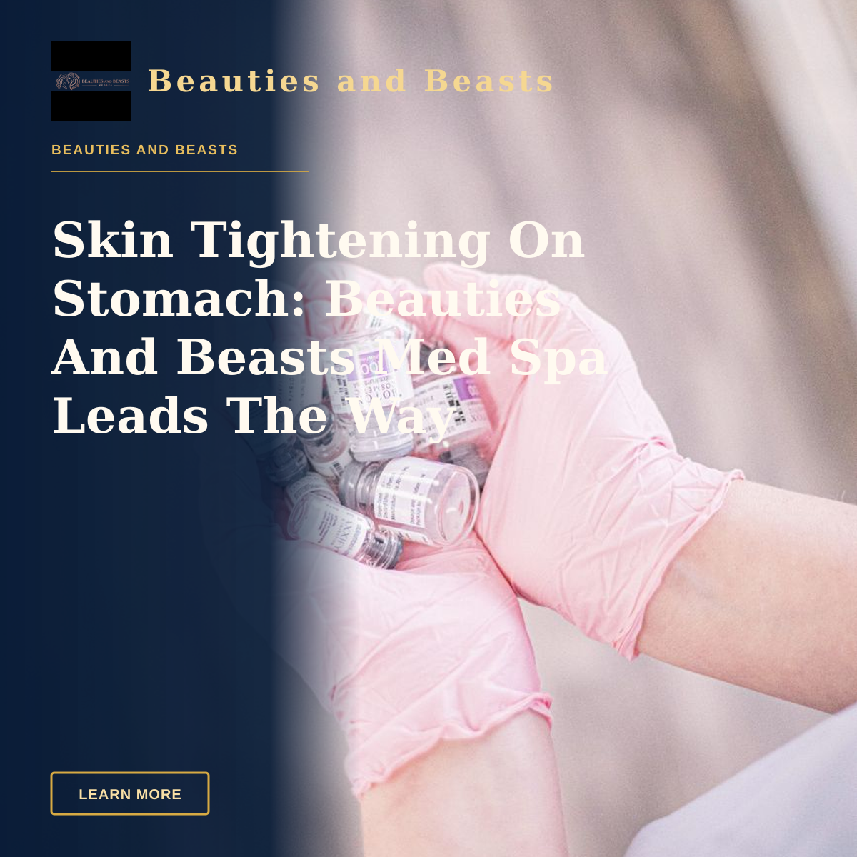 Skin Tightening On Stomach: Beauties And Beasts Med Spa Leads The Way — Aesthetic nurse wearing pink gloves holding vials of injectable treatments, symbolizing modern beauty care.