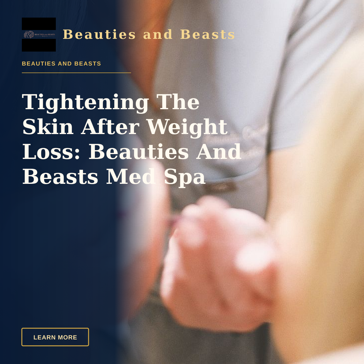 Tightening The Skin After Weight Loss: Beauties And Beasts Med Spa — Aesthetic nurse administering a cosmetic injection in a modern beauty clinic.