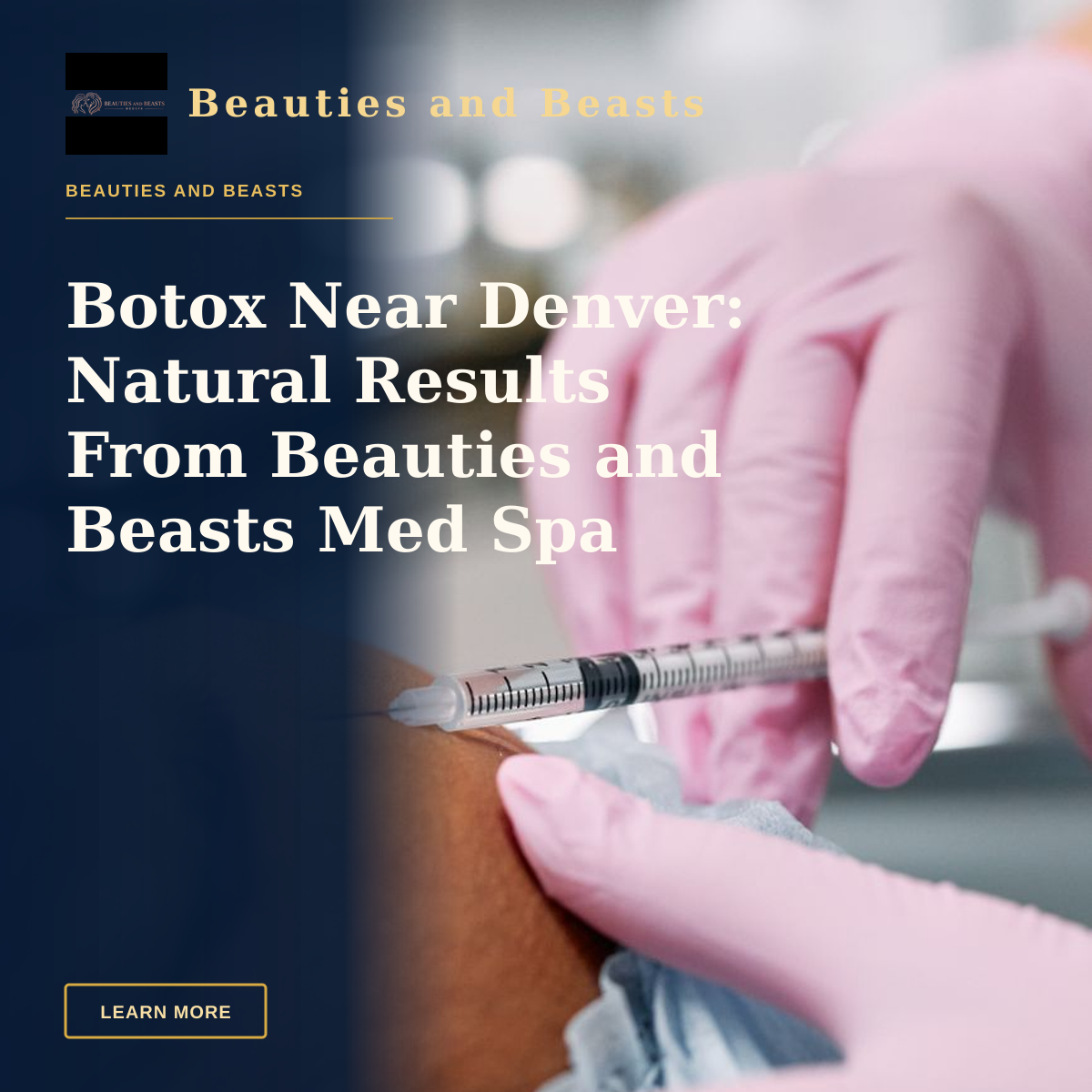 Botox Near Denver: Natural Results From Beauties and Beasts Med Spa — Detailed view of a cosmetic injection procedure being performed in a clinical setting.