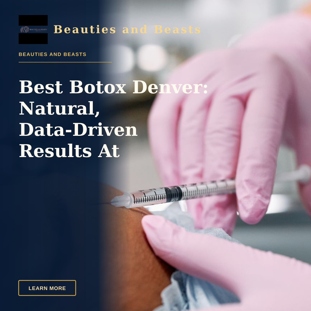 Best Botox Denver: Natural, Data‑Driven Results At Beauties And Beasts Med Spa — Detailed view of a cosmetic injection procedure being performed in a clinical setting.