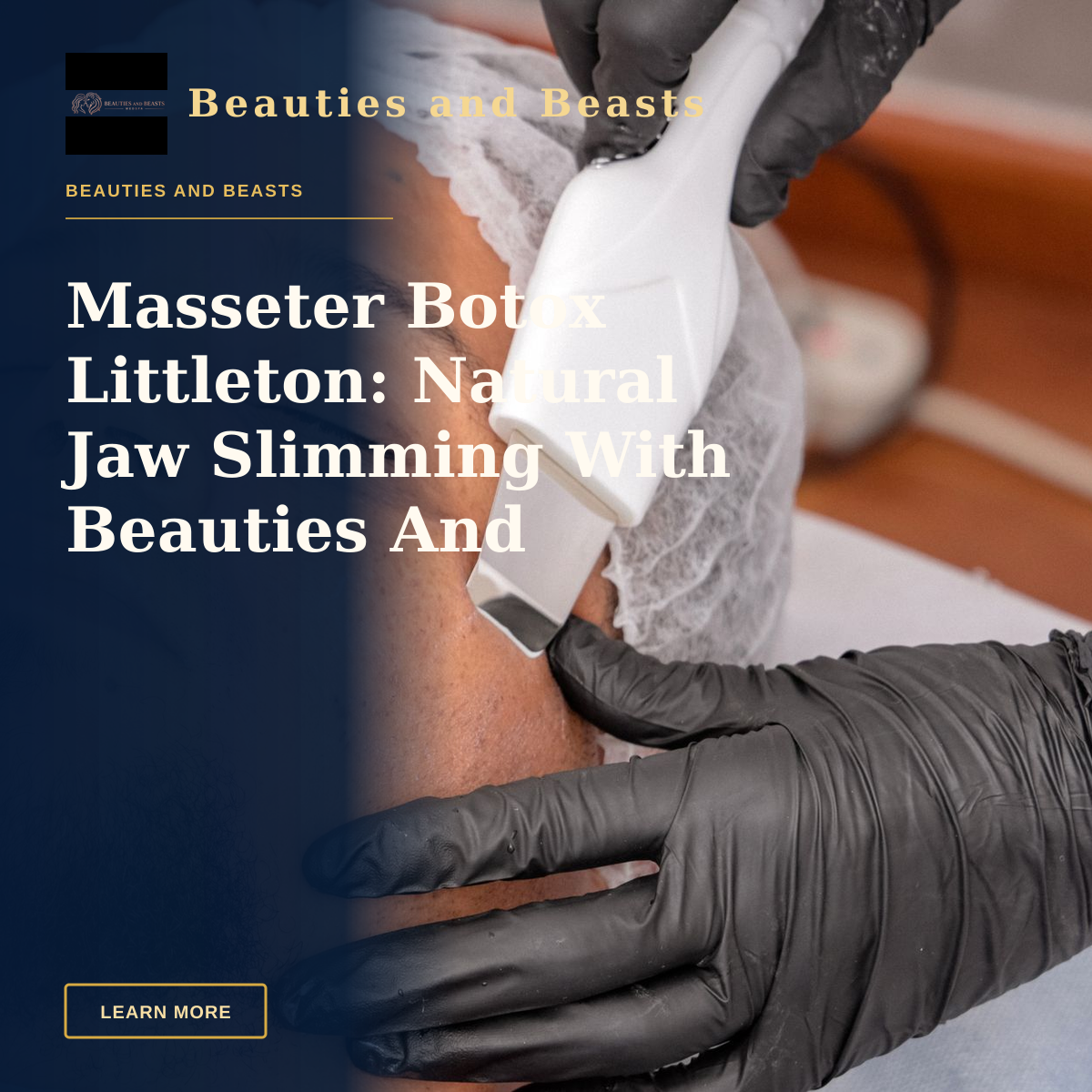 Masseter Botox Littleton: Natural Jaw Slimming With Beauties And Beasts — A man undergoing a facial treatment with advanced cosmetology equipment.