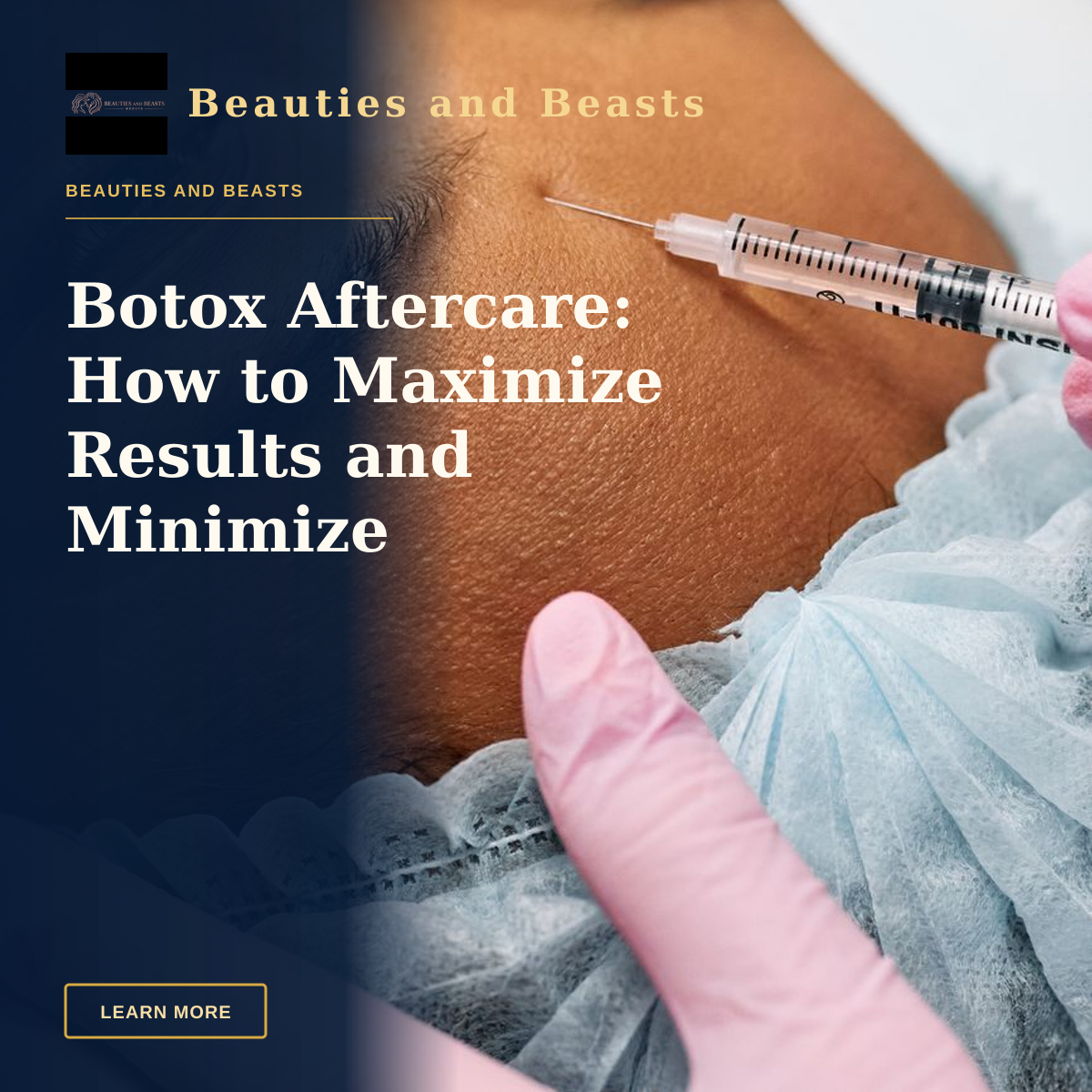 Botox Aftercare: How to Maximize Results and Minimize Complications — Close-up image of a cosmetic procedure showing a needle injecting into a forehead.