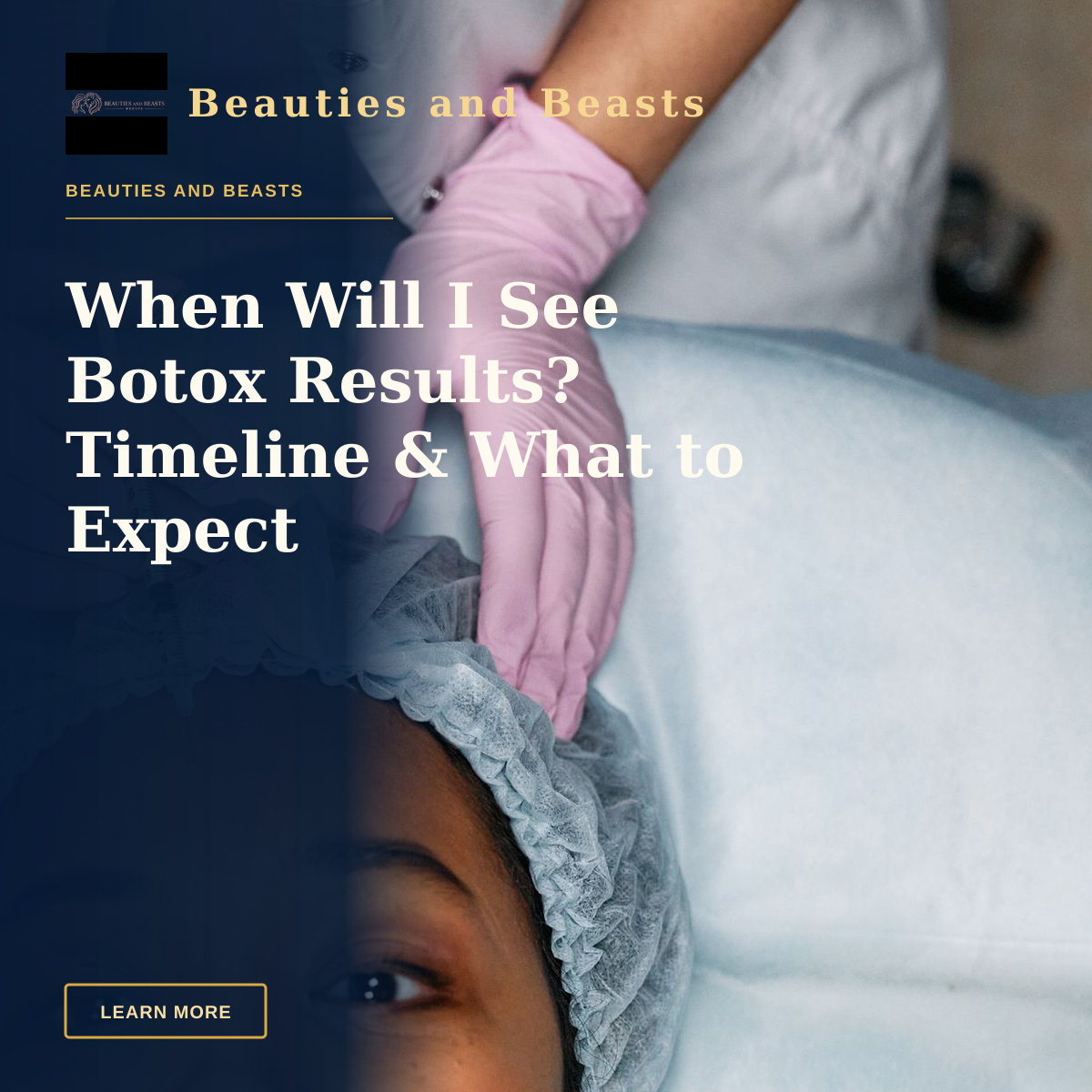When Will I See Botox Results? Timeline & What to Expect — Close-up view of a botox injection being administered to a woman's forehead, representing modern cosmetology.